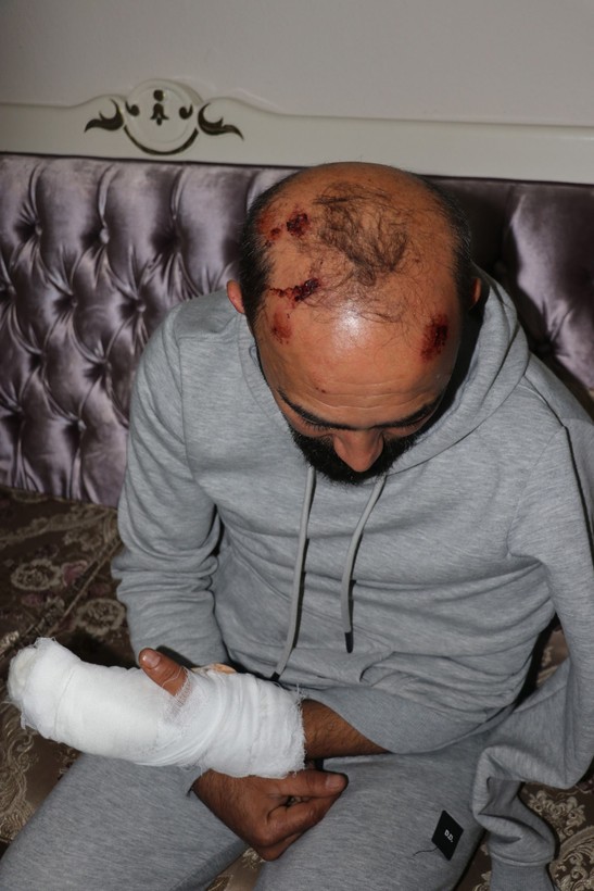 Antalya'da taksici Mesut Dertli, müşterisi tarafından feci şekilde dövülmüştü! Taksici, yaşadıklarını anlattı - Resim: 2