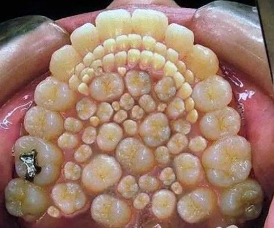 14 yaşında kuyruk kabusu yaşıyor! Babası kesmeye çalıştı - Resim: 5