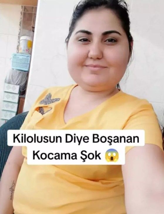 Değişimi gören şaştı kaldı: Kilolusun diye boşanan kocama şok😳 - Resim: 2