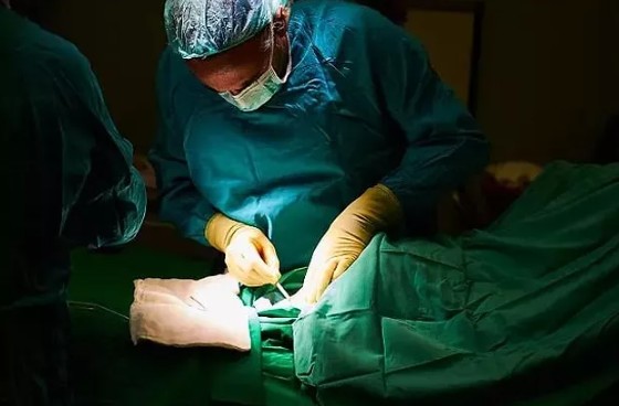 Polonya'da kabızlık çeken bir adama tüyler ürperten tedavi yöntemi uygulandı! "Anüsünden yılan balığı..." - Resim: 6