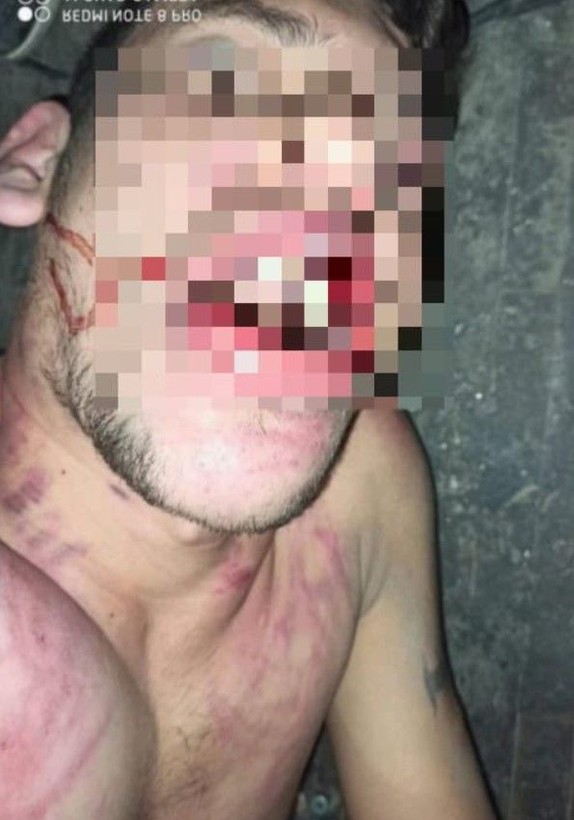 Antalya'da kan donduran olay! Maaşını istedi diye dişlerini kerpetenle söküp böcek yedirdiler - Resim: 6