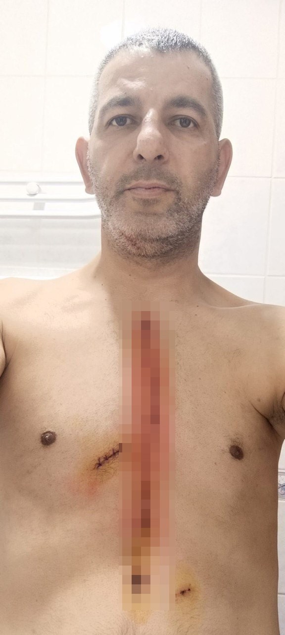 Tartışan çifti ayırırken kalbinden bıçaklandı! Korkunç olay kameraya yansıdı - Resim : 2