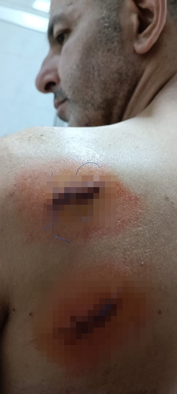 Tartışan çifti ayırırken kalbinden bıçaklandı! Korkunç olay kameraya yansıdı - Resim : 4