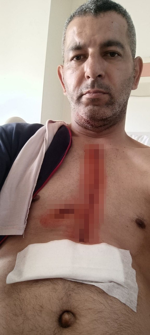 Tartışan çifti ayırırken kalbinden bıçaklandı! Korkunç olay kameraya yansıdı - Resim : 3