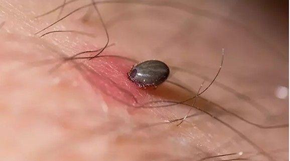 Kene can almaya devam ediyor: Ölü sayısı 8'e yükseldi - Resim: 3