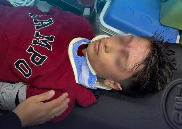 Erzurum'da okul çıkışı merdivenlerde izdiham: 23 öğrenci yaralandı - Resim: 2