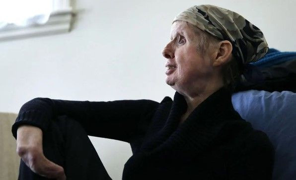 14 yıl baktığı maymun komşusunun yüzünü yedi! O anlarda kadının polisle telefon konuşması tüyler ürpertti - Resim: 17