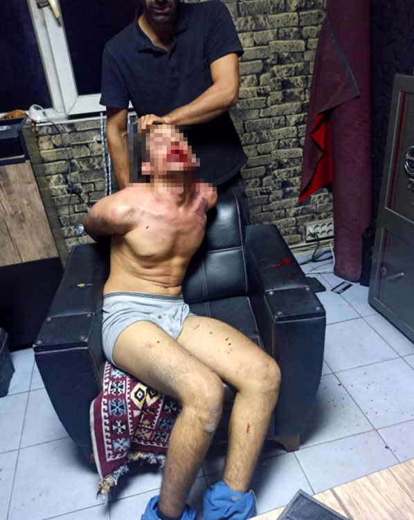 Böcek yedirip, dişlerini kırmışlardı! Savcının istediği ceza belli oldu - Resim : 2