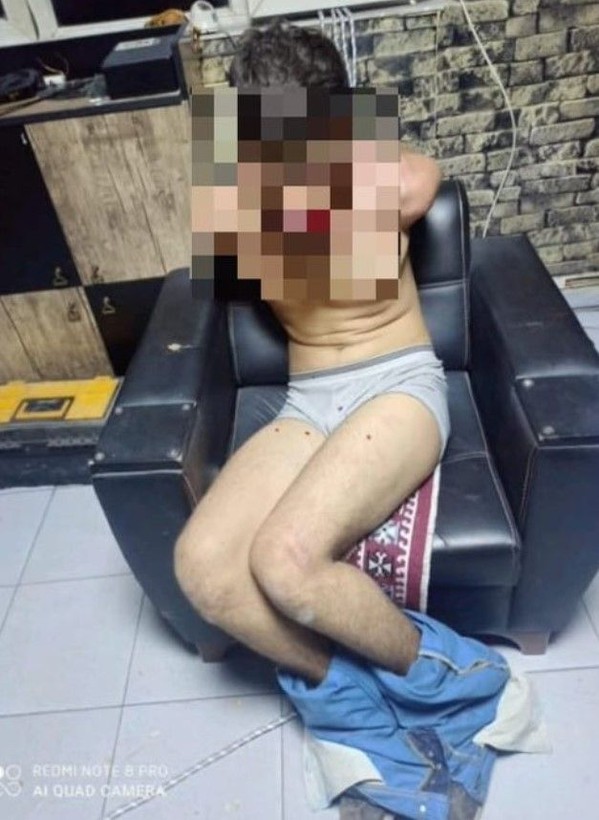 Antalya'da kan donduran olay! Maaşını istedi diye dişlerini kerpetenle söküp böcek yedirdiler - Resim: 3