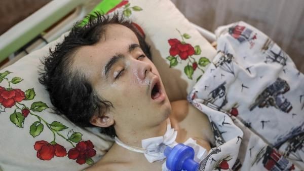 Arkadaşlarıyla yüzmeye gitti! Hayatı kabusa döndü! Makinelere bağlı yaşıyor - Resim: 6