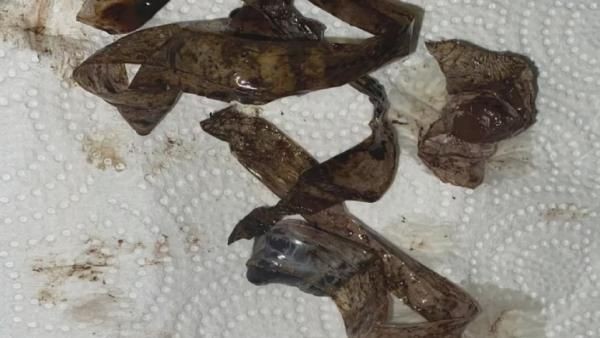 Feci ölüm! Midesine sakladığı uyuşturucu dolu kapsüller patladı! Son anları kamerada - Resim: 10