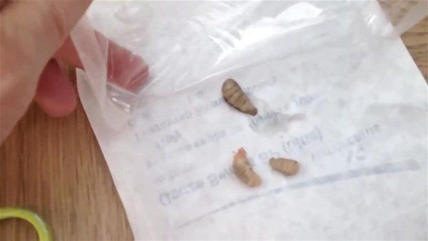 Sivilce zannettiği yaradan bakın ne çıktı! Kolundaki ağrı sonrası doktora gitti gözlerine inanamadı - Resim: 19
