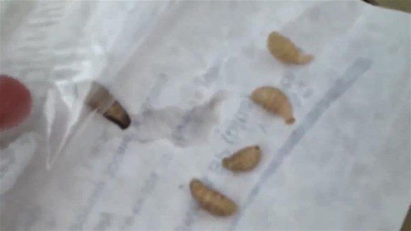Sivilce zannettiği yaradan bakın ne çıktı! Kolundaki ağrı sonrası doktora gitti gözlerine inanamadı - Resim: 22