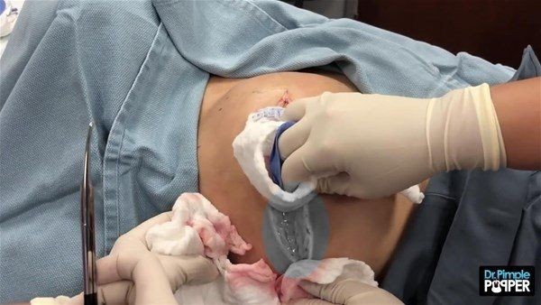 Sırtından çıkanlar görenleri görenleri dehşete düşürdü! Videosu kısa sürede milyonlarca kez izlendi - Resim: 6