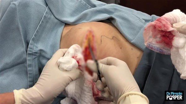 Sırtından çıkanlar görenleri görenleri dehşete düşürdü! Videosu kısa sürede milyonlarca kez izlendi - Resim: 7