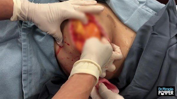 Sırtından çıkanlar görenleri görenleri dehşete düşürdü! Videosu kısa sürede milyonlarca kez izlendi - Resim: 10