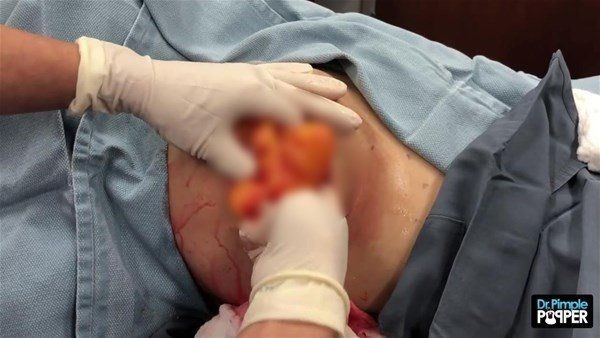 Sırtından çıkanlar görenleri görenleri dehşete düşürdü! Videosu kısa sürede milyonlarca kez izlendi - Resim: 11
