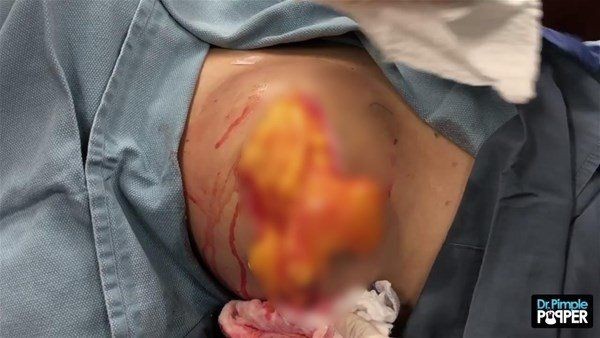 Sırtından çıkanlar görenleri görenleri dehşete düşürdü! Videosu kısa sürede milyonlarca kez izlendi - Resim: 12
