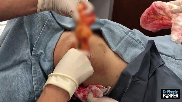 Sırtından çıkanlar görenleri görenleri dehşete düşürdü! Videosu kısa sürede milyonlarca kez izlendi - Resim: 13