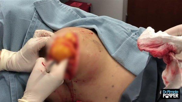 Sırtından çıkanlar görenleri görenleri dehşete düşürdü! Videosu kısa sürede milyonlarca kez izlendi - Resim: 16