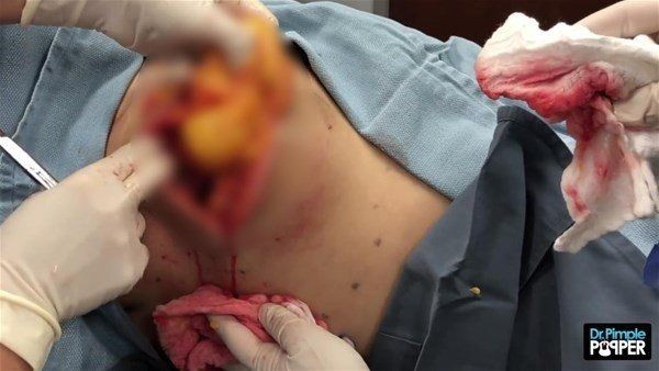 Sırtından çıkanlar görenleri görenleri dehşete düşürdü! Videosu kısa sürede milyonlarca kez izlendi - Resim: 17