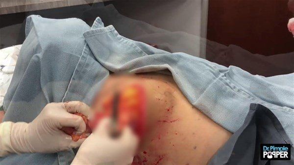 Sırtından çıkanlar görenleri görenleri dehşete düşürdü! Videosu kısa sürede milyonlarca kez izlendi - Resim: 18