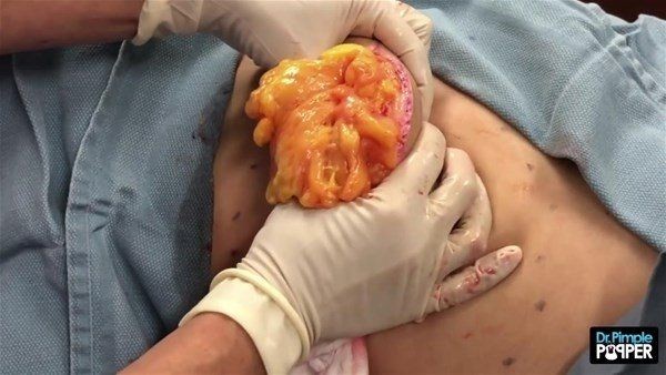 Sırtından çıkanlar görenleri görenleri dehşete düşürdü! Videosu kısa sürede milyonlarca kez izlendi - Resim: 21