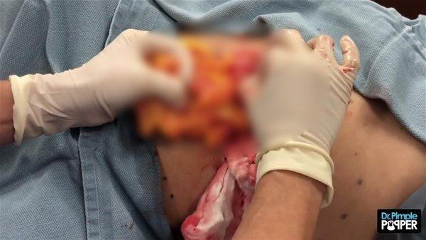 Sırtından çıkanlar görenleri görenleri dehşete düşürdü! Videosu kısa sürede milyonlarca kez izlendi - Resim: 22