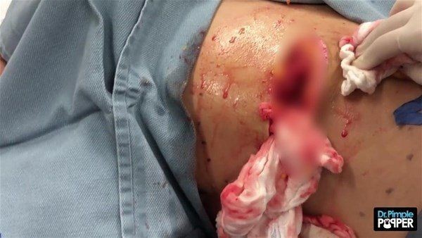 Sırtından çıkanlar görenleri görenleri dehşete düşürdü! Videosu kısa sürede milyonlarca kez izlendi - Resim: 23