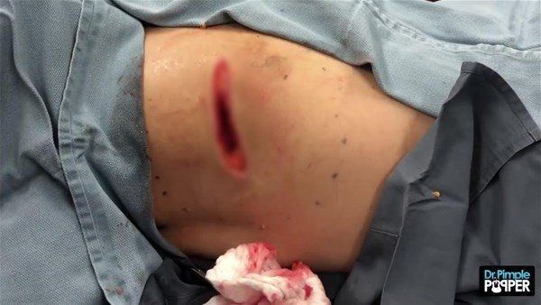 Sırtından çıkanlar görenleri görenleri dehşete düşürdü! Videosu kısa sürede milyonlarca kez izlendi - Resim: 24
