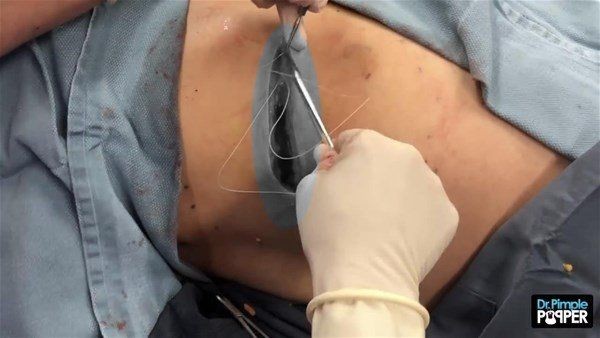 Sırtından çıkanlar görenleri görenleri dehşete düşürdü! Videosu kısa sürede milyonlarca kez izlendi - Resim: 25