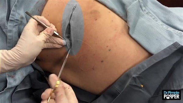 Sırtından çıkanlar görenleri görenleri dehşete düşürdü! Videosu kısa sürede milyonlarca kez izlendi - Resim: 26
