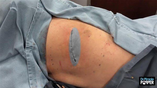 Sırtından çıkanlar görenleri görenleri dehşete düşürdü! Videosu kısa sürede milyonlarca kez izlendi - Resim: 28