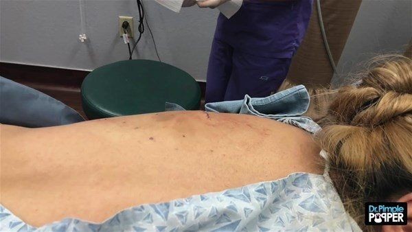 Sırtından çıkanlar görenleri görenleri dehşete düşürdü! Videosu kısa sürede milyonlarca kez izlendi - Resim: 29