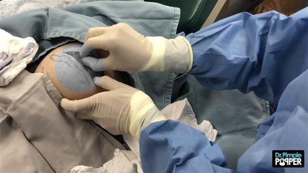 Kolundaki şişlikten bakın ne çıktı! Giderek şişmeye başlayınca dayanamayıp doktorun yolunu tuttu - Resim: 6