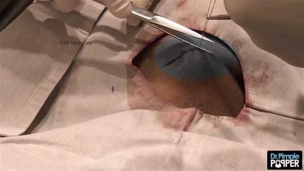 Kolundaki şişlikten bakın ne çıktı! Giderek şişmeye başlayınca dayanamayıp doktorun yolunu tuttu - Resim: 9