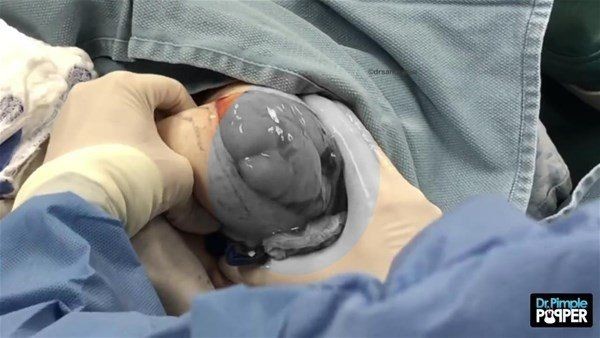Kolundaki şişlikten bakın ne çıktı! Giderek şişmeye başlayınca dayanamayıp doktorun yolunu tuttu - Resim: 11