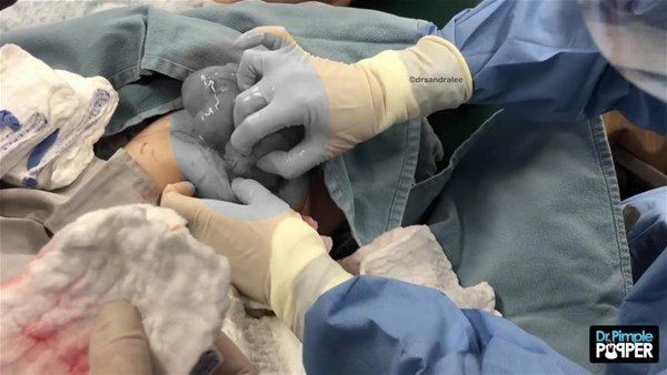 Kolundaki şişlikten bakın ne çıktı! Giderek şişmeye başlayınca dayanamayıp doktorun yolunu tuttu - Resim: 13