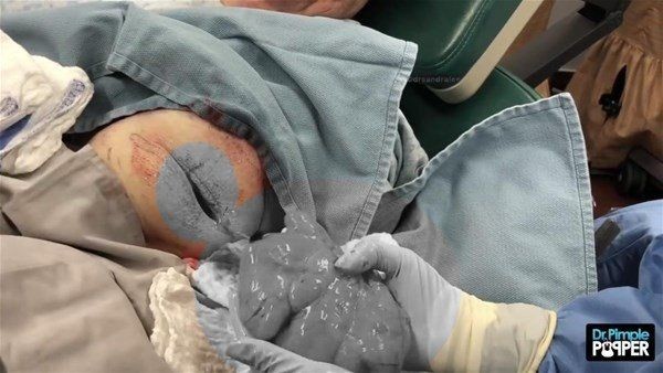 Kolundaki şişlikten bakın ne çıktı! Giderek şişmeye başlayınca dayanamayıp doktorun yolunu tuttu - Resim: 14