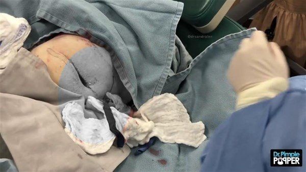 Kolundaki şişlikten bakın ne çıktı! Giderek şişmeye başlayınca dayanamayıp doktorun yolunu tuttu - Resim: 15
