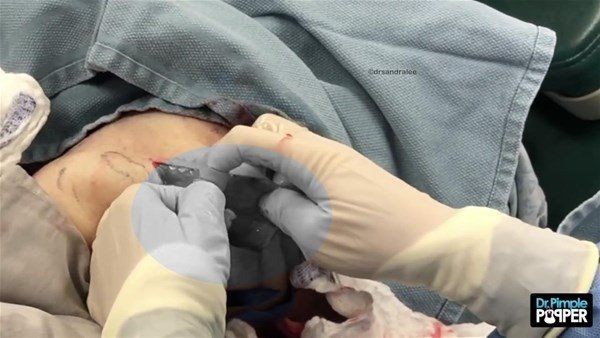Kolundaki şişlikten bakın ne çıktı! Giderek şişmeye başlayınca dayanamayıp doktorun yolunu tuttu - Resim: 16