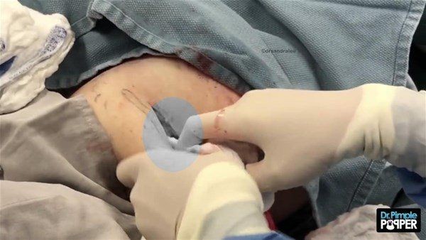 Kolundaki şişlikten bakın ne çıktı! Giderek şişmeye başlayınca dayanamayıp doktorun yolunu tuttu - Resim: 17
