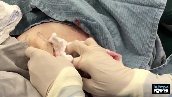 Kolundaki şişlikten bakın ne çıktı! Giderek şişmeye başlayınca dayanamayıp doktorun yolunu tuttu - Resim: 18