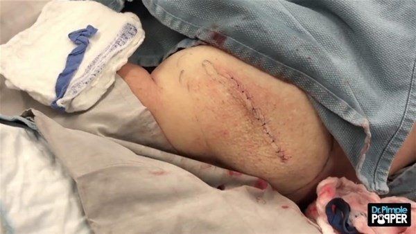 Kolundaki şişlikten bakın ne çıktı! Giderek şişmeye başlayınca dayanamayıp doktorun yolunu tuttu - Resim: 24