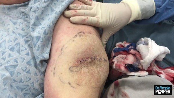 Kolundaki şişlikten bakın ne çıktı! Giderek şişmeye başlayınca dayanamayıp doktorun yolunu tuttu - Resim: 26