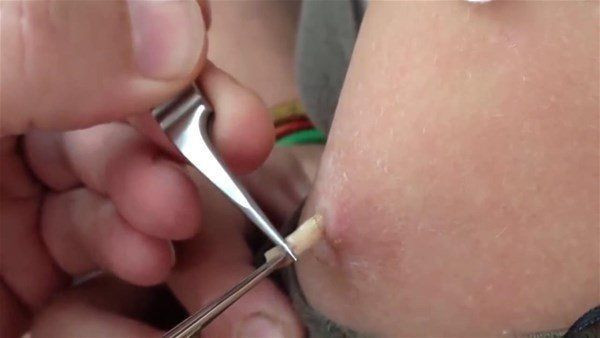 Vücutlarından kurtçuk fışkırıyor! Depremzede ailenin hayatı kabusa döndü! Doktorlar bile şaştı kaldı - Resim: 15