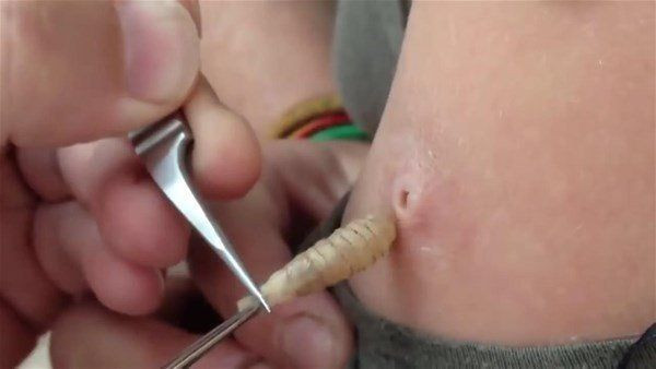 Vücutlarından kurtçuk fışkırıyor! Depremzede ailenin hayatı kabusa döndü! Doktorlar bile şaştı kaldı - Resim: 16