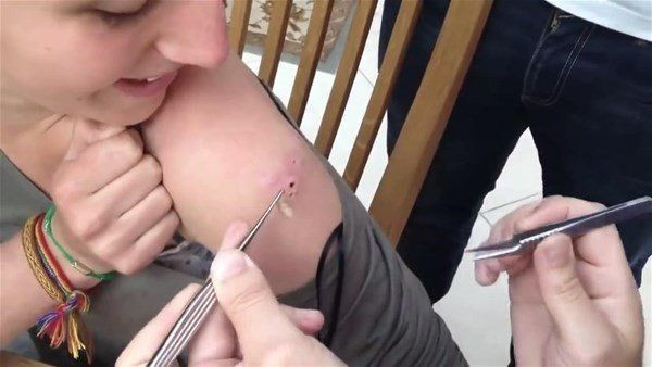Vücutlarından kurtçuk fışkırıyor! Depremzede ailenin hayatı kabusa döndü! Doktorlar bile şaştı kaldı - Resim: 23