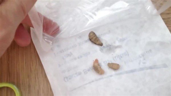 Vücutlarından kurtçuk fışkırıyor! Depremzede ailenin hayatı kabusa döndü! Doktorlar bile şaştı kaldı - Resim: 24
