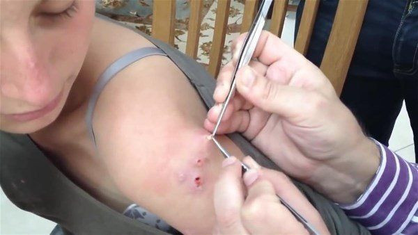 Vücutlarından kurtçuk fışkırıyor! Depremzede ailenin hayatı kabusa döndü! Doktorlar bile şaştı kaldı - Resim: 25